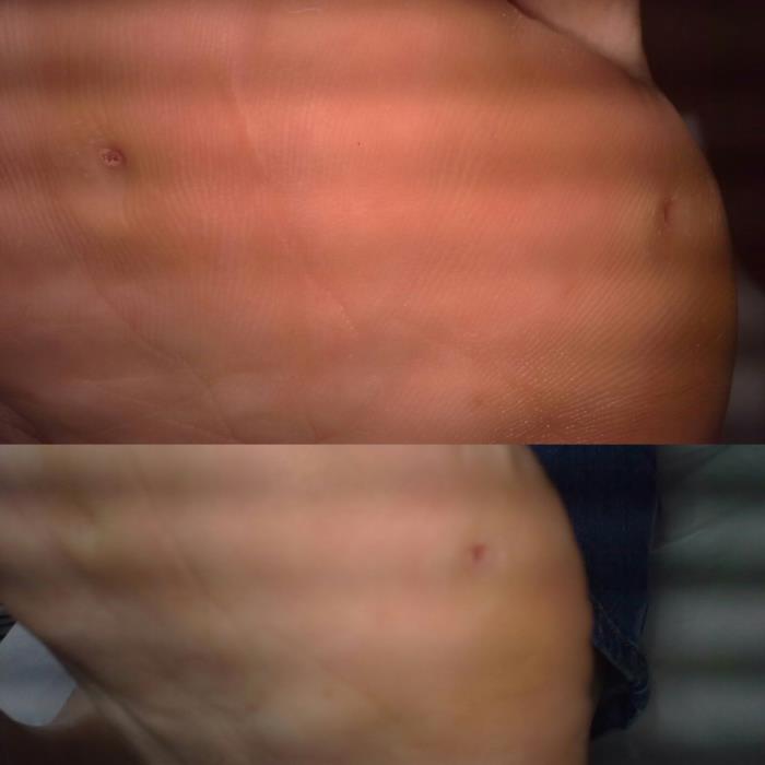 Аппаратный педикюр в Хмельницком - изображениe 4