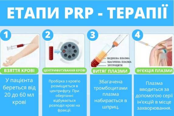 Косметологія Плазмотерапія PRPPPP - изображениe 8