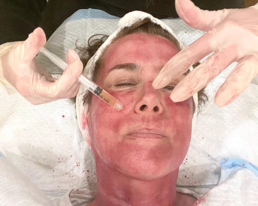 Косметологія Плазмотерапія PRPPPP - изображениe 10